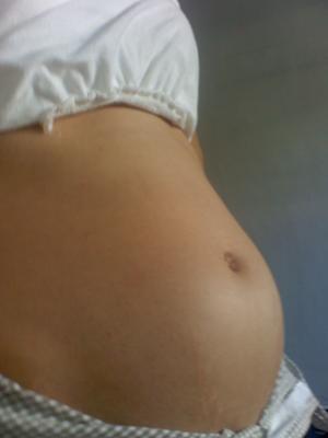 Pics Of 9 Weeks Pregnant. 9 Weeks With Fraternal Twins