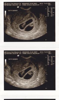 My twins at 7 wks