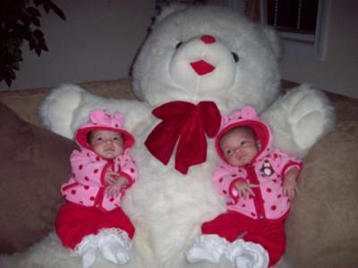 My miracle mono mono twins Alyssa and Alexis