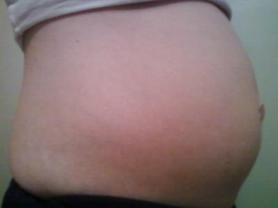 Side view at 14 wks