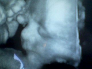 Baby B