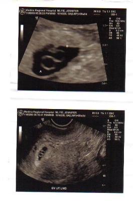 pregnancy due date pregnancy due date
