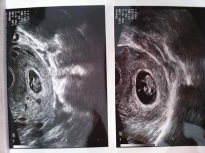 Twins at 8 weeks