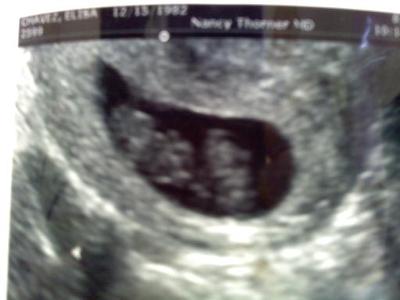 twin due date calculator twin due date calculator