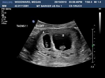 Our beautiful babies at 7.5 weeks!
