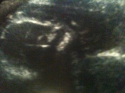 When looking at the pic you can see the baby's profile. The 