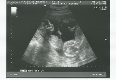 Beautiful Babies 16 weeks ultrasound image