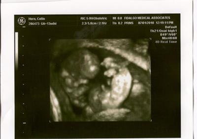 3d version at around 10 weeks