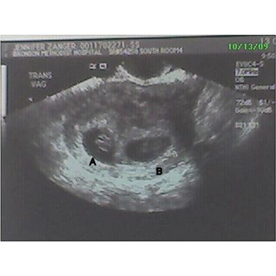 8-9 weeks