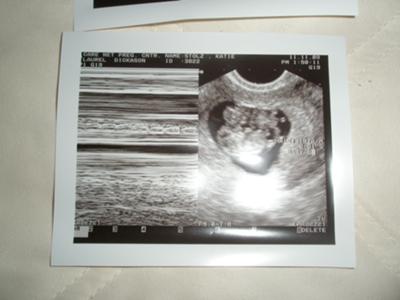 Ultrasound with heartrate.