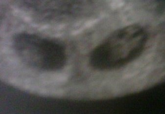 Our Twins
