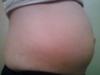 Side view at 14 wks