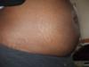 4 month Twins Belly