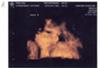 Aviana Joelle Pool - 28 Weeks