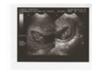 1st picture of Inocentes Twins
