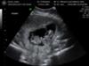Baby A from the top of head & arms stretched out. Baby B stretched out.