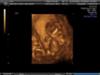 You can see Baby B's head at the bottom left-hand corner of the screen