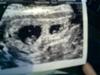 My twins