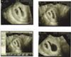 A=6wk4day (Top Right)          B=6wk1day (Bottom Left)
