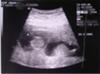 Approx. 12 weeks