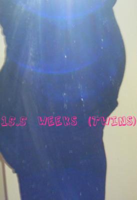 15 weeks with TWINS