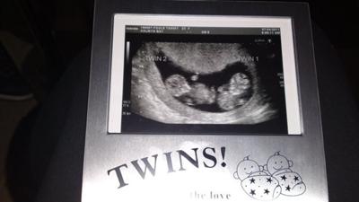 twins at 10 weeks 2 days 21596885