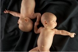 ivf infant babies