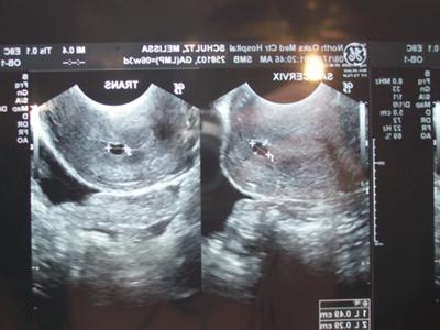 my recent ultrasounds