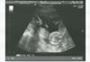Beautiful Babies 16 weeks ultrasound image