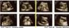 Aviana Joelle & Zander Mitchell  - 19 week ultrasound