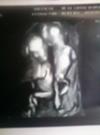 This was an awesome 4D ultrasound!