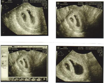 A=6wk4day (Top Right)          B=6wk1day (Bottom Left)