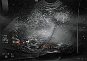4 week ultrasound