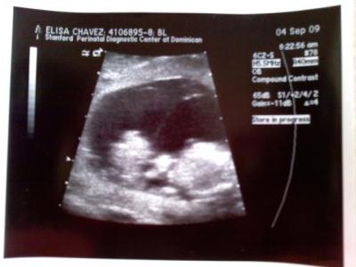 12 week ultrasound