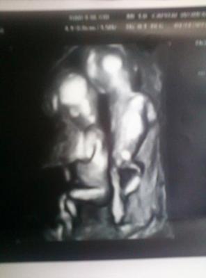 This was an awesome 4D ultrasound!